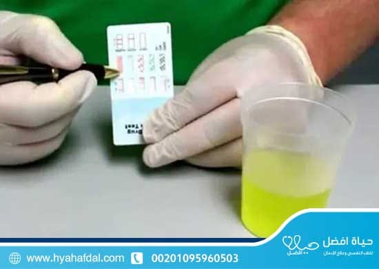 خطوات إجراء تحليل المخدرات