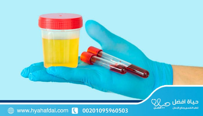 مدة بقاء الحشيش في البول والدم |كيف تؤثر المدة على نتائج التحليل؟